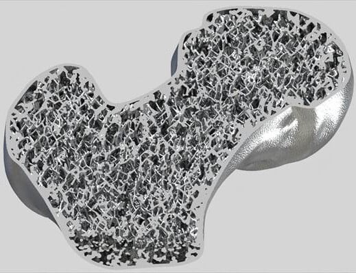 Medical-Implicit-Modeling-Bone