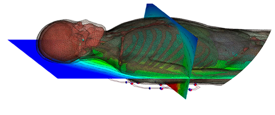 Preprocessing and Meshing